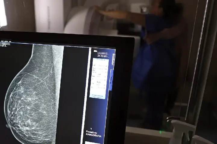 Plano de saúde terá que cobrir mamografia digital para todas as idades